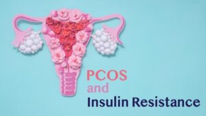 PCOS and Insulin Resistance: The Hidden Connection